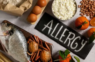 Alergia a Alimentos Dr Alonso Gutiererz