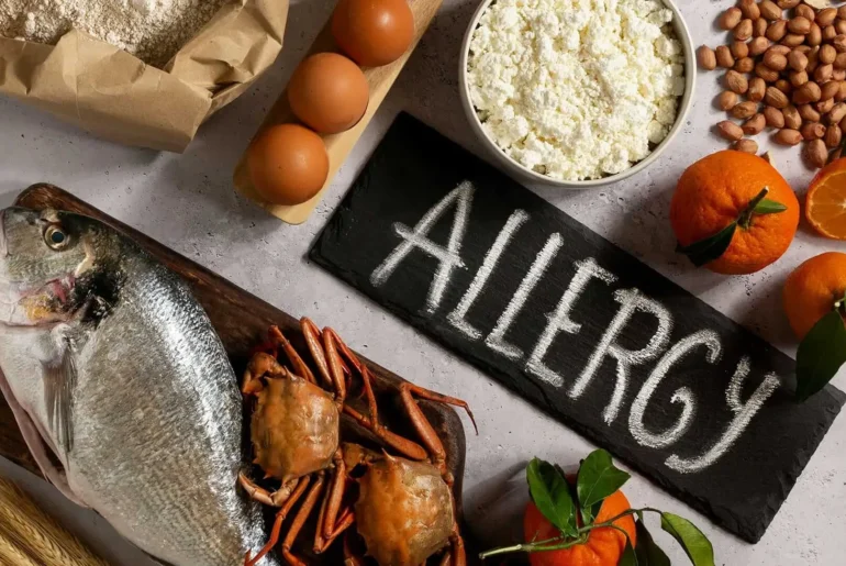 Alergia a Alimentos Dr Alonso Gutiererz